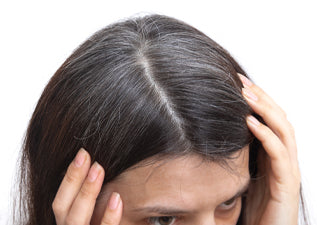 Read This To Keep Dandruff At Bay in Winters!